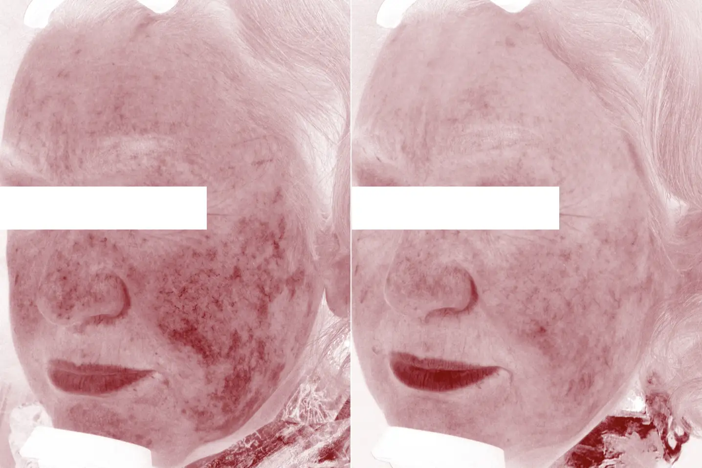 LATO SIN - LUCE POLARIZ